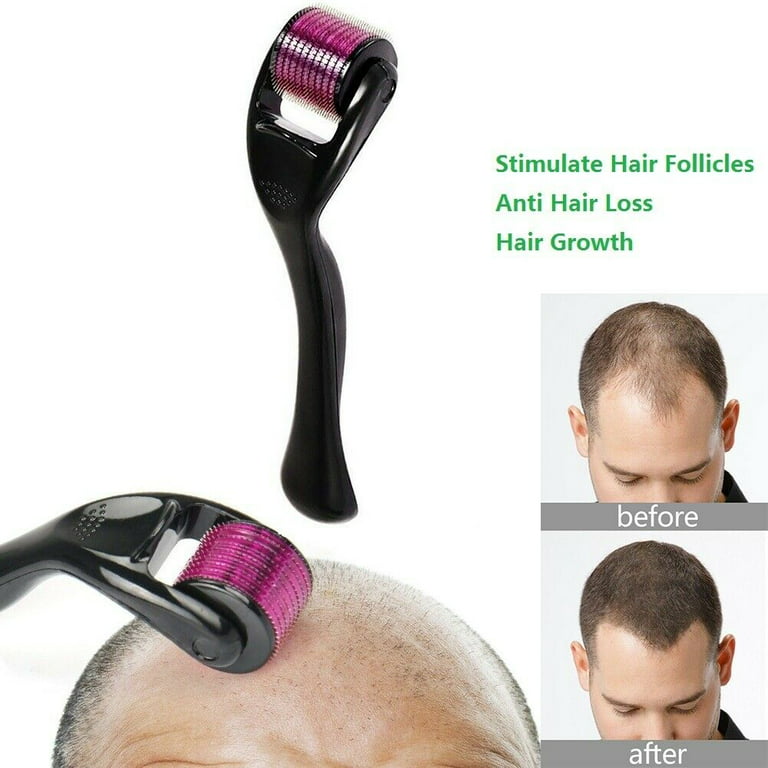 Derma Roller Hair Therapy Micro-Needle | Derma Roller for Hair re-growth & Skin